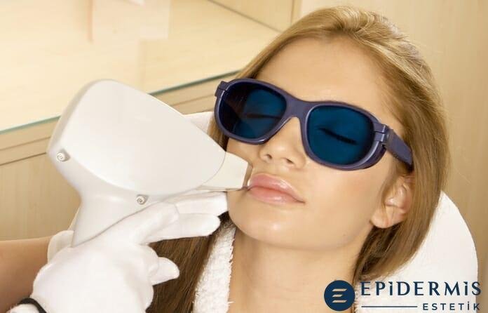 Lazer Epi̇lasyon Hangi̇ Bölgelere Uygulanır?
