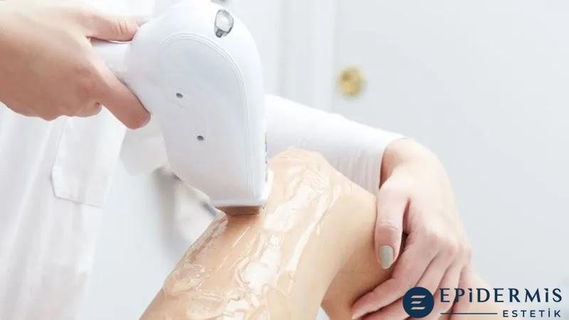 Lazer Epi̇lasyon Tedavi̇si̇ Sonrası İz Kalır mı? Leke ve Yani Ri̇ski̇ Var Mı?